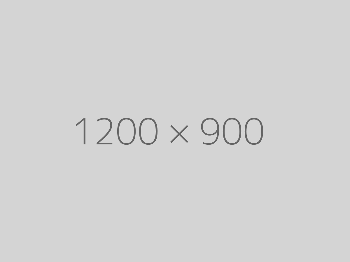 Female, 28 – Primary Rhinoplasty - Before